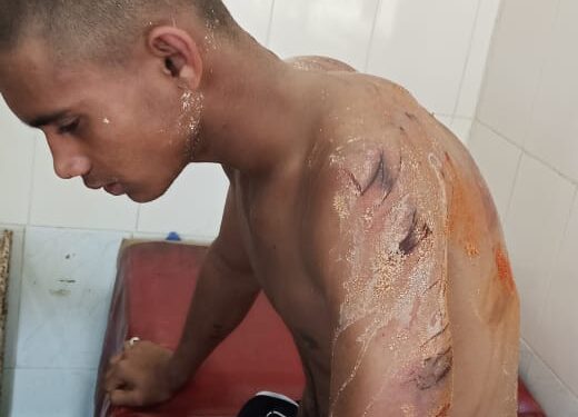 A youth accused of beating up