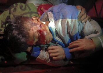 Youth injured by shot: 2 guns recover