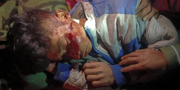 Youth injured by shot: 2 guns recover