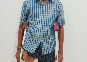 Bhavaranjan Receives New Prosthetic Leg After 18 Years