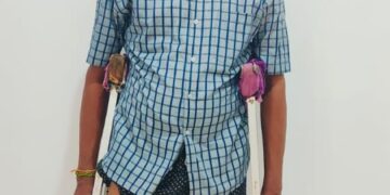 Bhavaranjan Receives New Prosthetic Leg After 18 Years