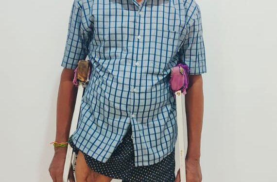 Bhavaranjan Receives New Prosthetic Leg After 18 Years