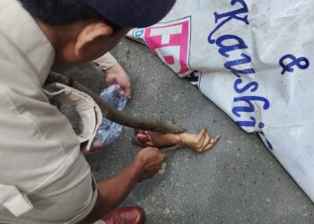 Woman Injured in Auto-Rickshaw Collision Near Old Raj Bhavan