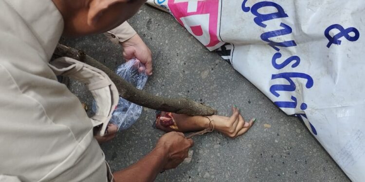 Woman Injured in Auto-Rickshaw Collision Near Old Raj Bhavan