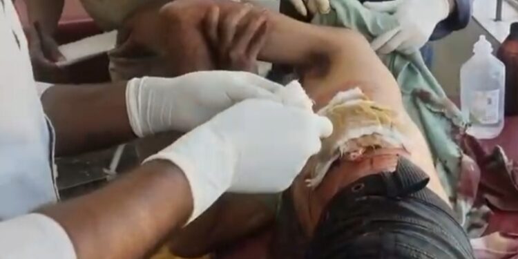 Youth Injured in BSF Firing During Alleged Smuggling Attempt on Indo-Bangladesh Border