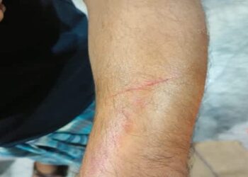 Mosque Panel Clash Turns Violent in Churaibari