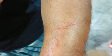 Mosque Panel Clash Turns Violent in Churaibari