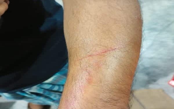 Mosque Panel Clash Turns Violent in Churaibari