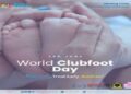Doctors Stress Early Clubfoot Treatment at North Tripura Awareness Programme