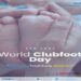 Doctors Stress Early Clubfoot Treatment at North Tripura Awareness Programme