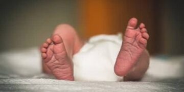 Tripura doctors save 18-day-old baby with rare intestinal condition